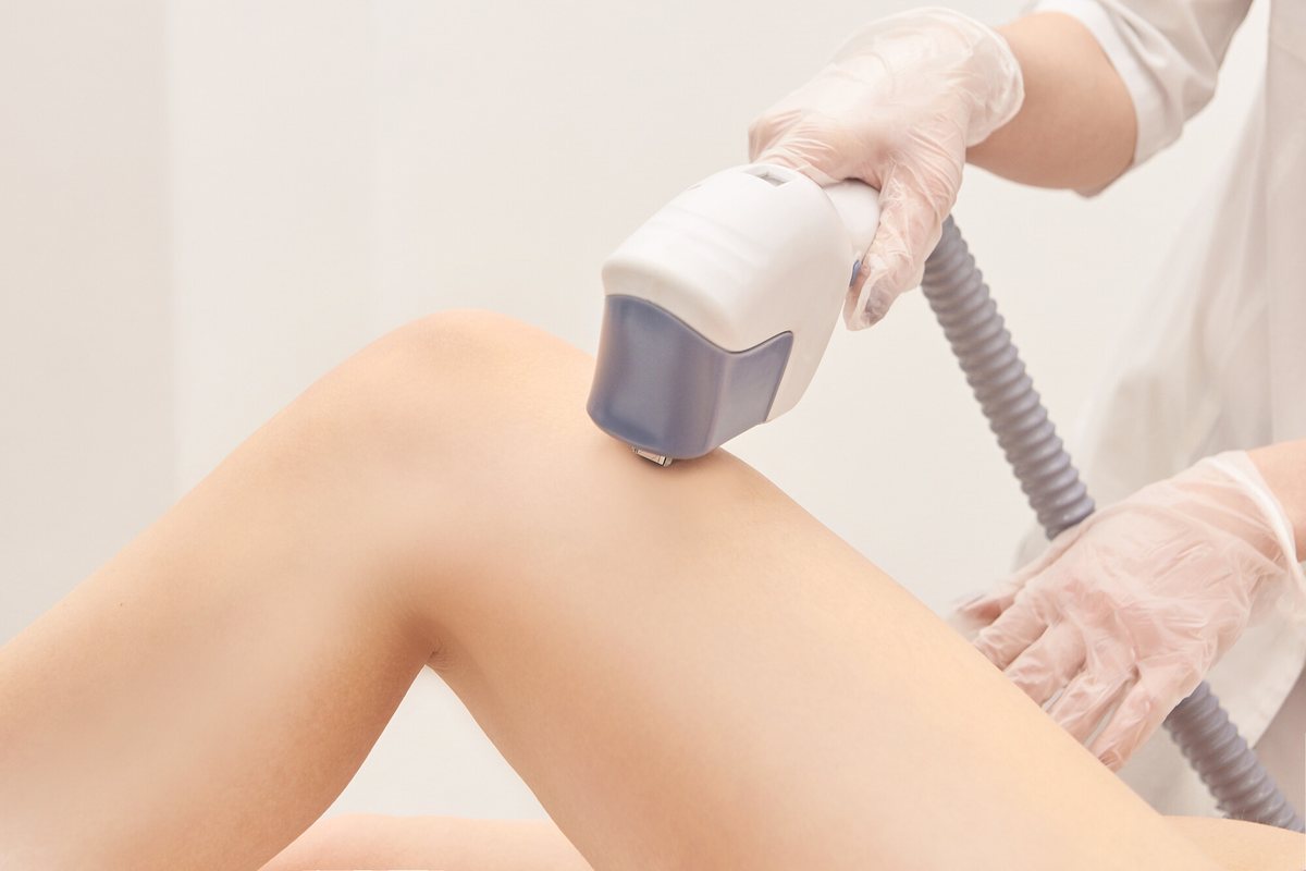 Operatrice con guanti trasparenti appoggia un manipolo laser bianco e lilla sulla gamba nuda, su sfondo chiaro